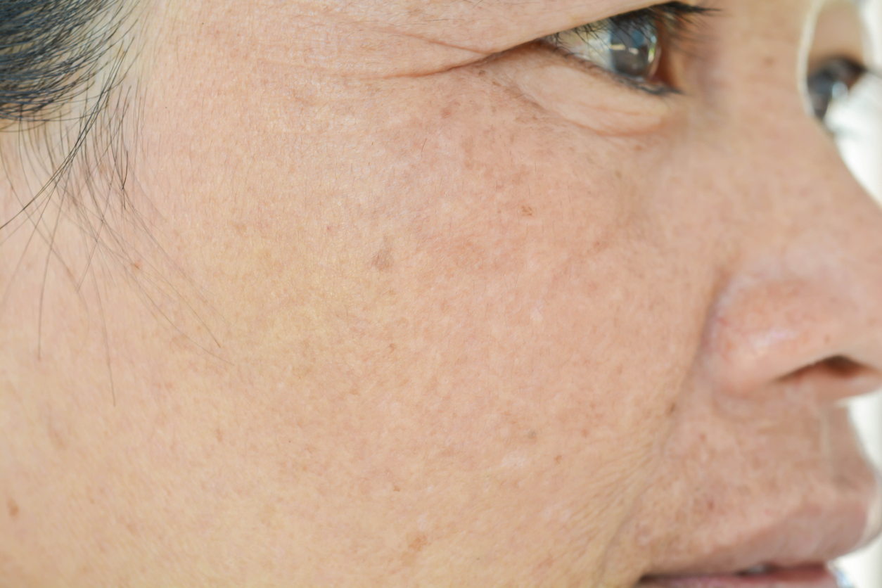 ”肌質改善”のアプローチ法 3選