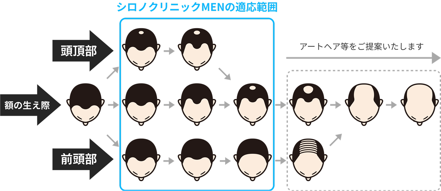 治療の適応範囲