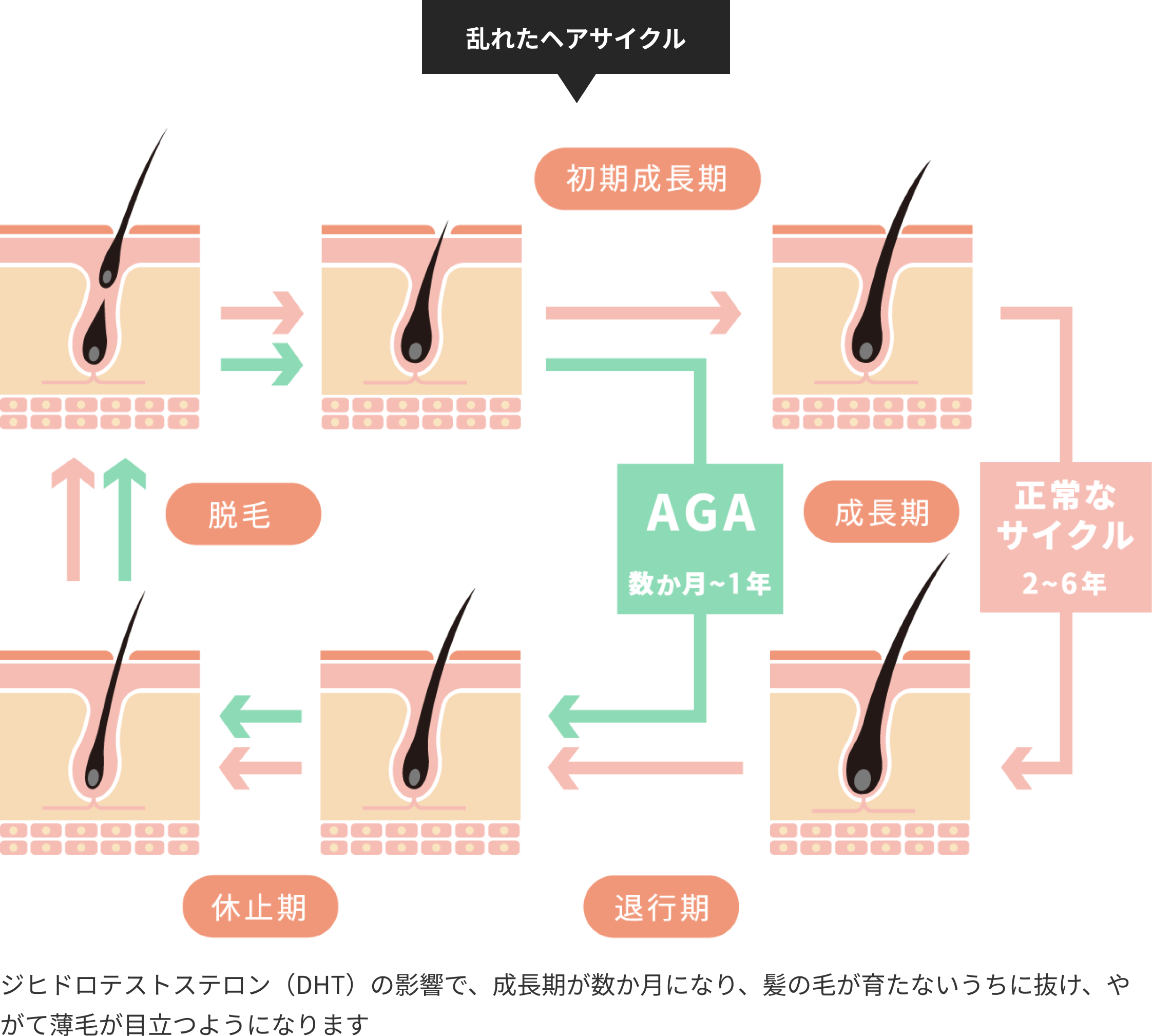 乱れたヘアサイクル