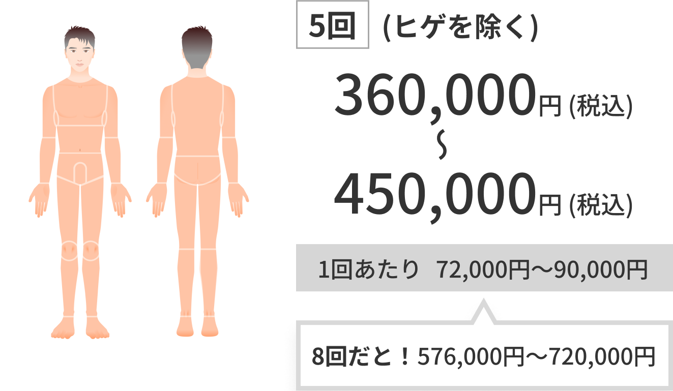 5回(ヒゲを除く) 360,000~450,000円（税込）