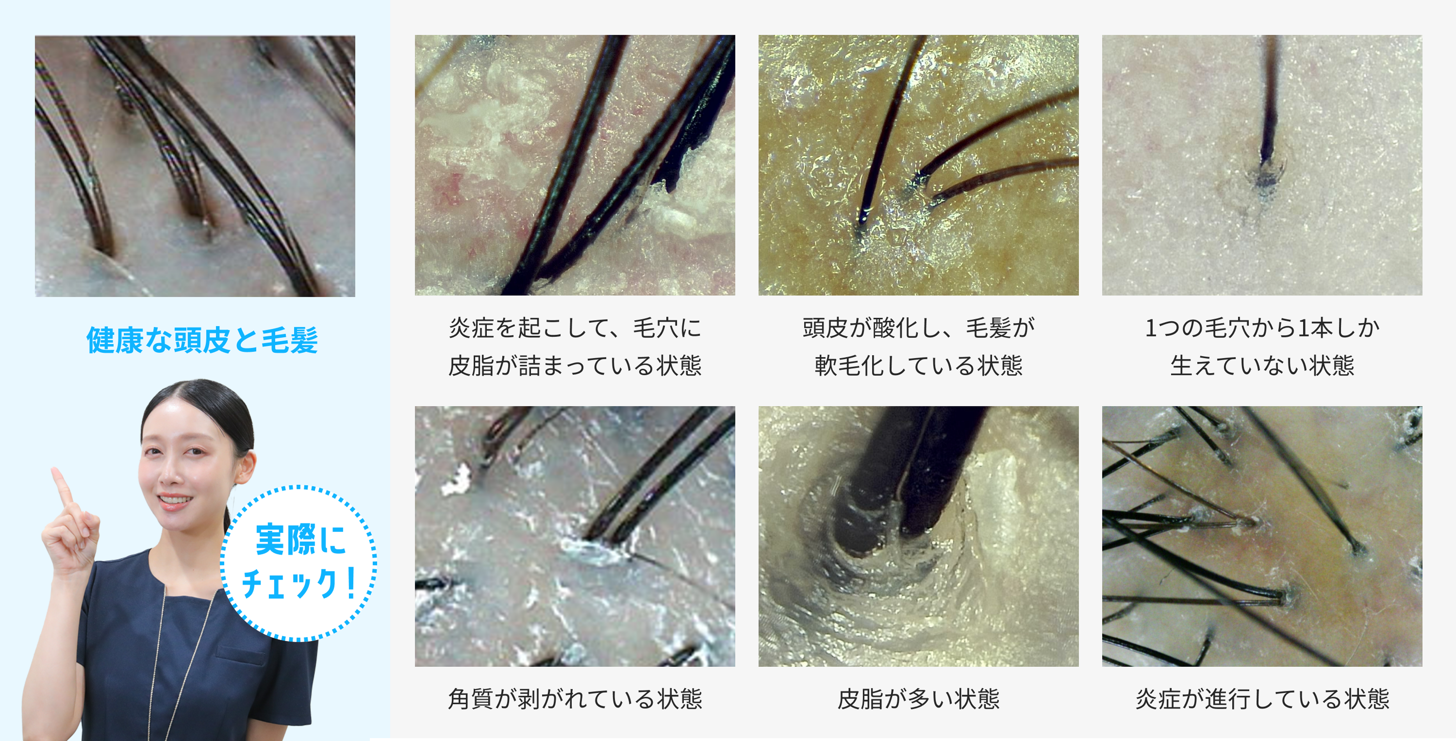 頭皮分析モード 頭皮の画像