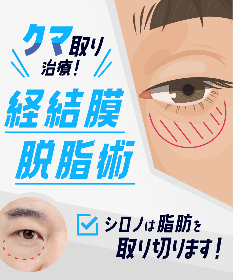 目のたるみ・クマ取り治療