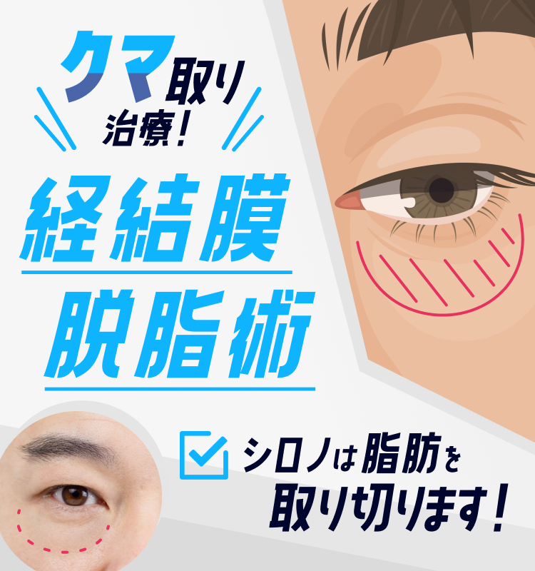 目のたるみ・クマ取り治療（目の下のふくらみ取り）