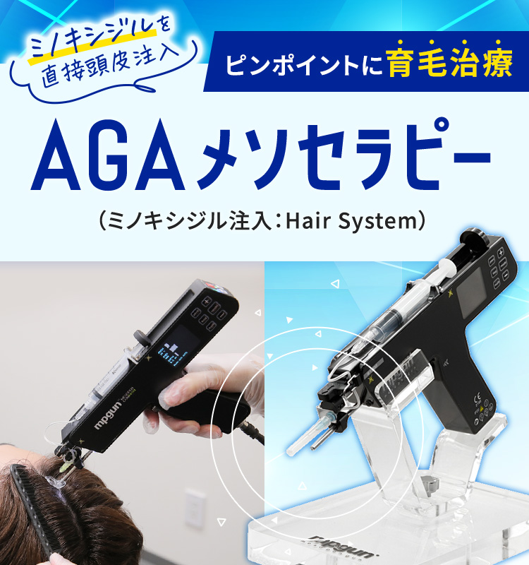 AGAメソセラピー（ミノキシジル注入：Hair System）