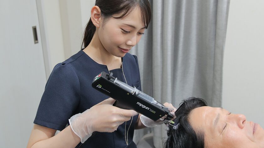 AGAメソセラピー（ミノキシジル：Hair System）