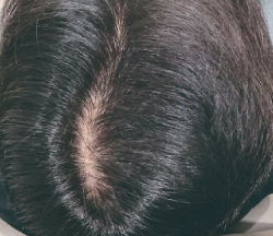 症例写真アフター