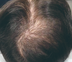 症例写真ビフォー